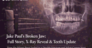 Jake Paul Broken Jaw